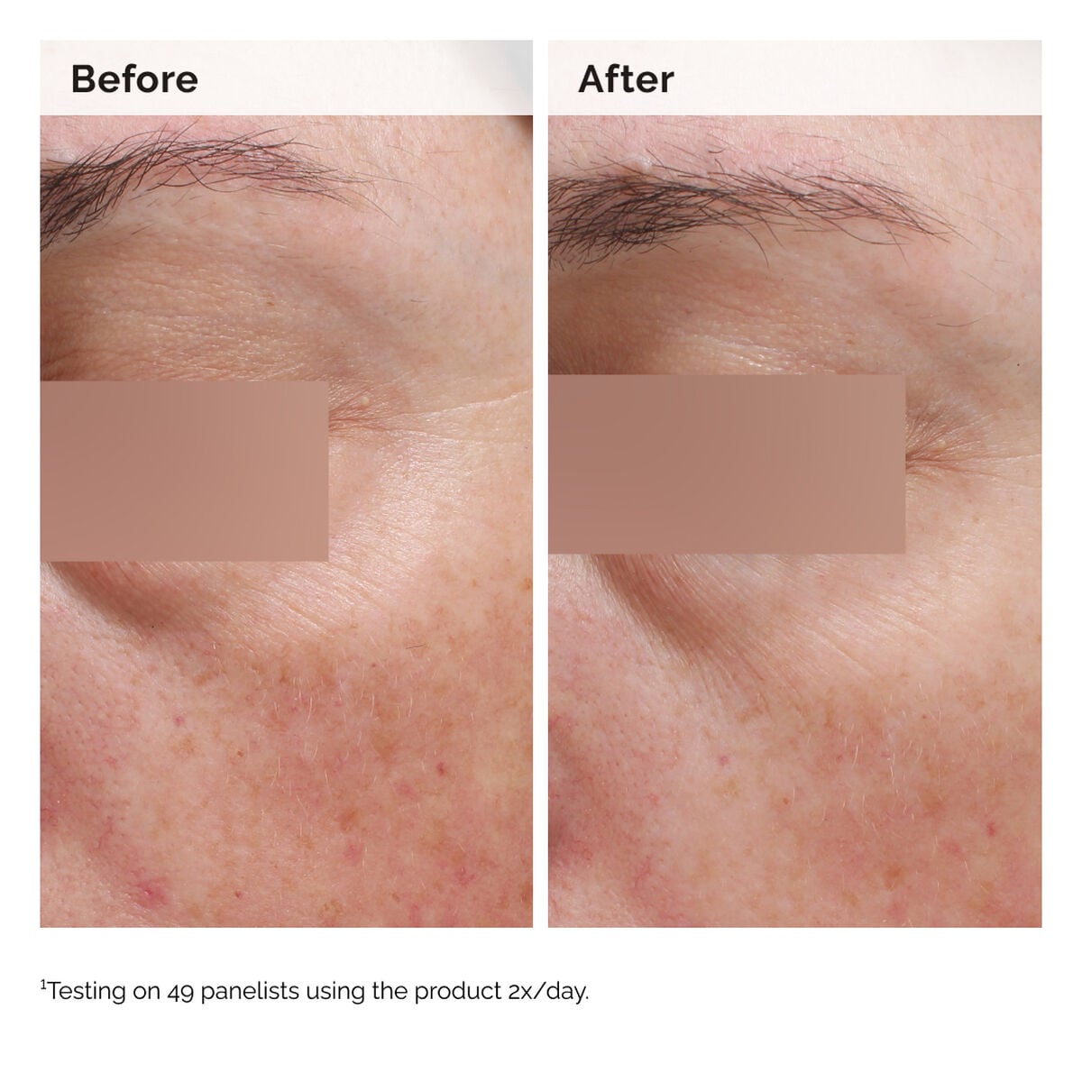 niacinamide-5-face-and-body-emulsion-b6 2024-08-23-ORD-Nia-5pct-Face-Body-B-A-Elasticity-Global-02-1x1.jpg