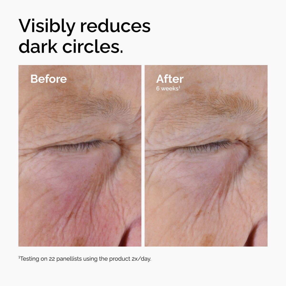 caffeine-solution-5-egcg-eye-serum-g4 ord-caffeine-solution-egcg-dark-circles-before-after.jpg