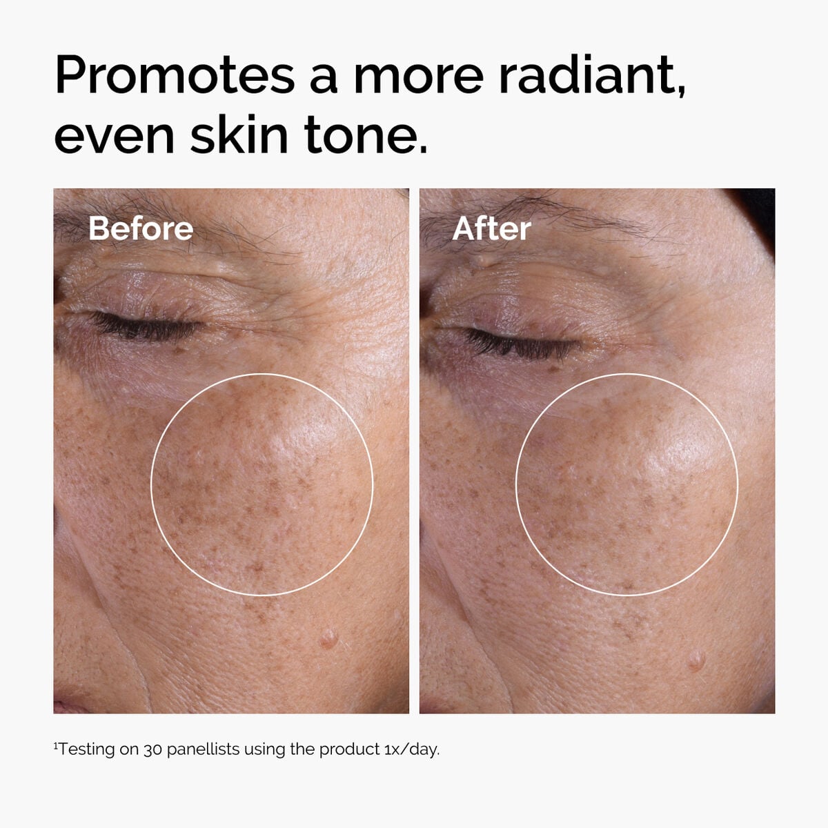 glycolic-acid-7-exfoliating-toner-r6 ord-glycolic-before-after-radiance.jpg