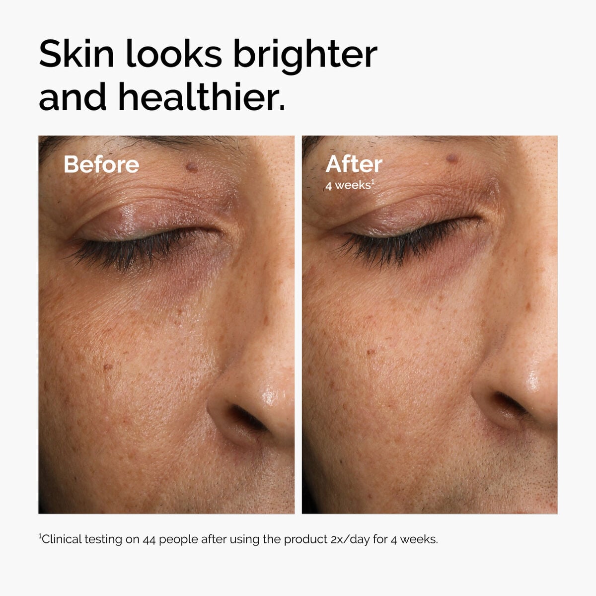 multi-antioxidant-radiance-serum-a8 ord-mars-before-after-healthy.jpg