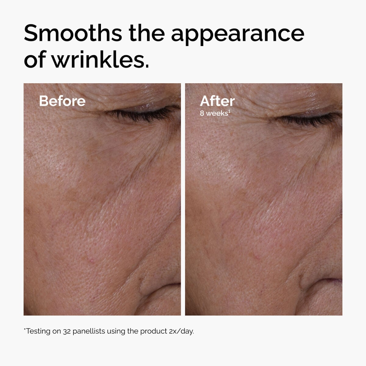 multi-peptide-ha-serum-q8 ord-multi-peptide-ha-serum-wrinkles-before-after.jpg