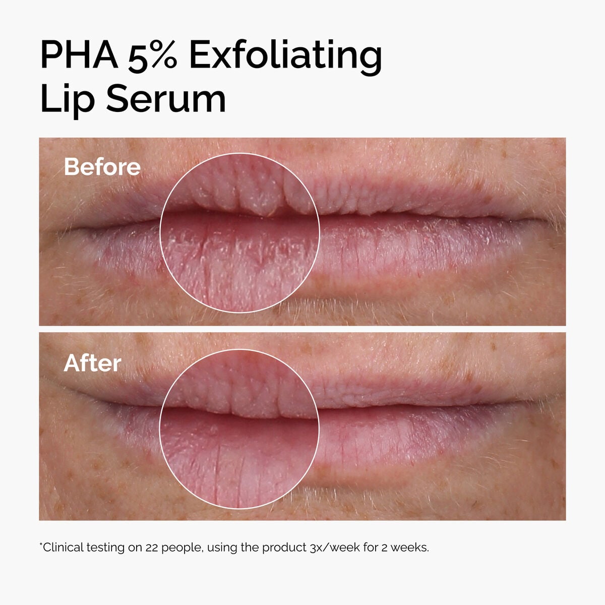 pha-5-exfoliating-lip-serum-p7 ord-pha-5pct-lip-exfoliating-serum-before-after.jpg